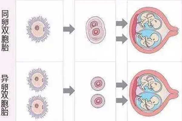 同卵双胞胎与异卵双胞胎